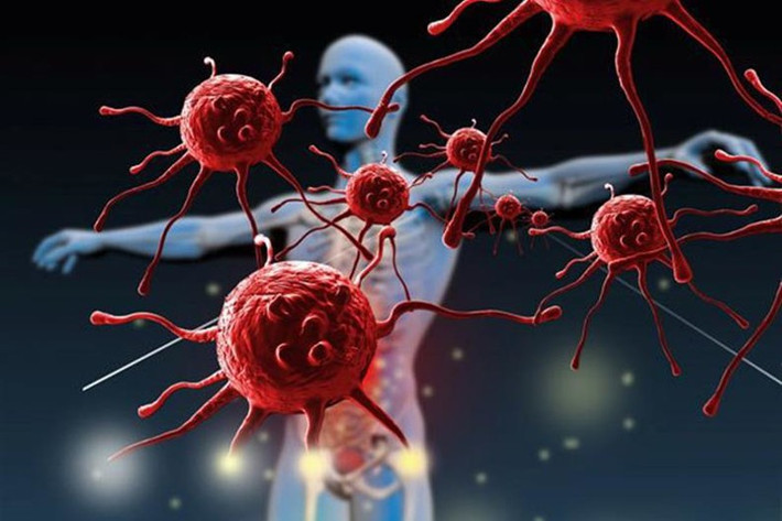 Ung Thư Ở Việt Nam: Tỷ Lệ, Trẻ Hóa & Giải Pháp Bảo Vệ Từ Bảo Hiểm Nhân Thọ