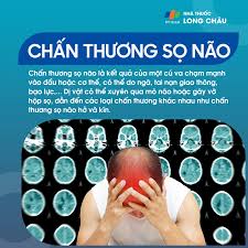 Chấn Thương Sọ Não: Dấu Hiệu, Di Chứng Và Giải Pháp Tài Chính Từ Bảo Hiểm